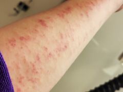 -御灸堂古法艾灸(东坝店)