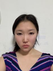 -四川米兰柏羽医学美容医院