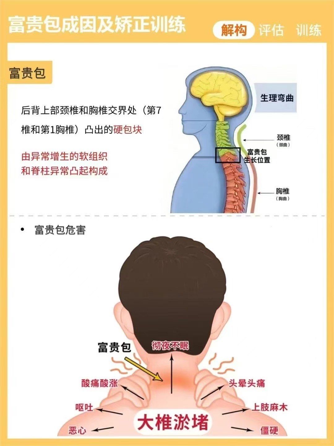 颈后有个大包俗称"富贵包",是一种不良体