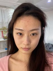 体验后-YooMee优美智能科技美肤机构