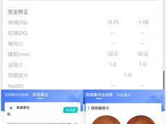 -宝岛眼镜(北京亚运村旗舰店)
