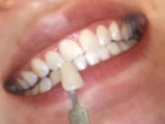 -微笑牙科口腔(三亚迎宾院区)
