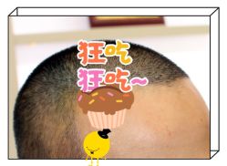 -大麦微针植发全国连锁