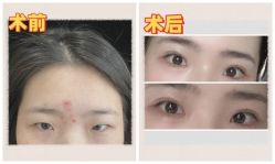 -素美医疗美容·西南眼鼻整形·修复基地