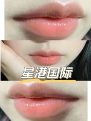 -星港国际·Skin皮肤专研·皮肤管理