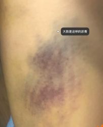 -一美医疗美容