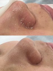 -SKIN79皮肤管理中心