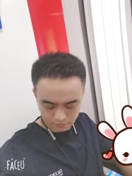 -大麦微针植发丨全国连锁