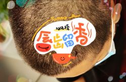 -大麦微针植发全国连锁