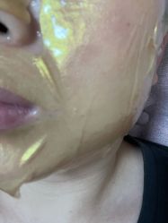 体验后-JUVA郑州欧华医疗美容医院