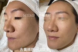 -美愈美肤MEIYU SKIN