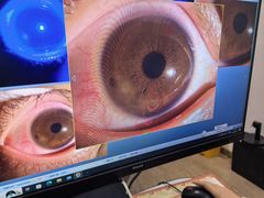 -昆明爱尔眼科医院