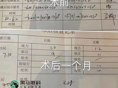 -黑马眼科·近视手术