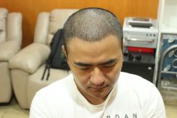 点击看大图 -大麦微针植发丨全国连锁