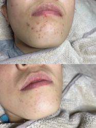 -Doria salon 小颜皮肤