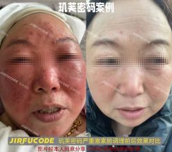 -元熙兰积皮肤管理