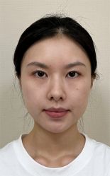 体验前-四川米兰柏羽医学美容医院