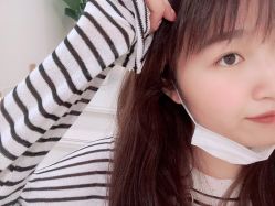 体验后-郡艺医疗美容·微整·眼鼻吸脂