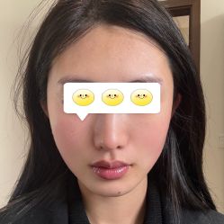 点击看大图 -广州美莱医疗美容医院