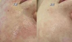 -LUNA皮相美·骨相美高级美感