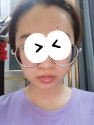 体验后-禾美嘉医疗美容