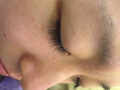 点击看大图 iphone_upload_pic-光SPA科技美肤