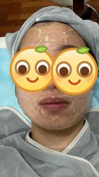 点击看大图 体验前-北京英煌医疗美容