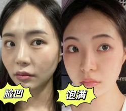 点击看大图 -深圳艺星医疗美容医院