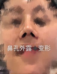 体验后-深圳鹏爱悦心医疗美容医院