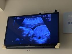 -杭州贝瑞斯美华妇儿医院·早孕·产检·儿科