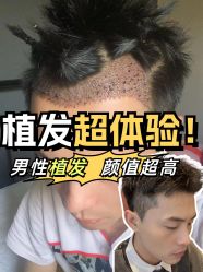 -雍禾植发全国连锁