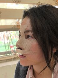 体验后-深圳广和门诊部·整形医疗美容