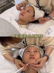 -大华韩艺整形美容医院