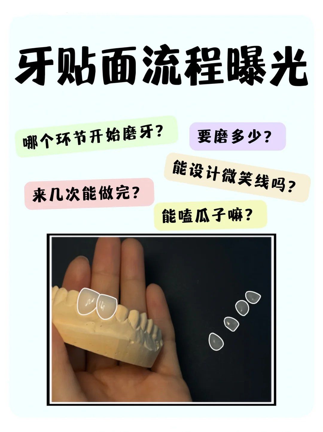 全瓷贴面流程|➡️必问清单