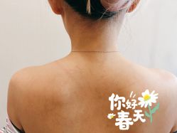 体验前-More摩尔医美の注射线雕光电中心