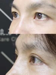 -联合丽格·张菡丽格医疗美容