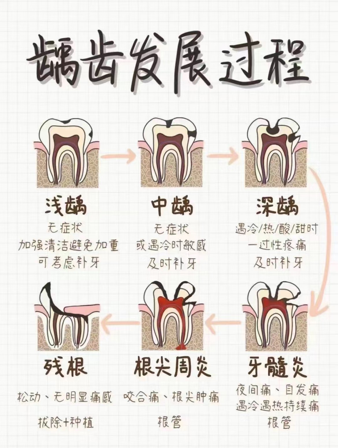 "小洞不补 大洞吃苦
�确实是这样的龋齿形成后是无法自行恢复