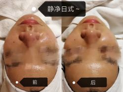 点击看大图 -JNK皮肤管理中心