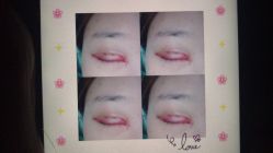 -西安伊美尔医疗美容医院