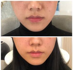 点击看大图 -深圳美莱医疗美容医院