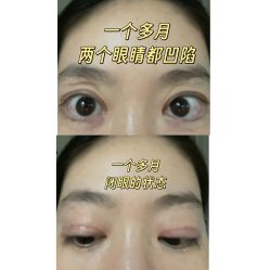 -丰联丽格医疗美容·联合丽格眼整形中心