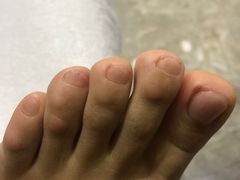 -郑远元专业修脚房(宣化路店)