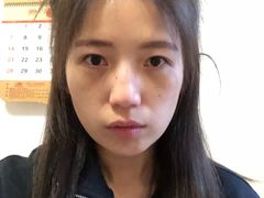 体验后-上海华安整形外科门诊部