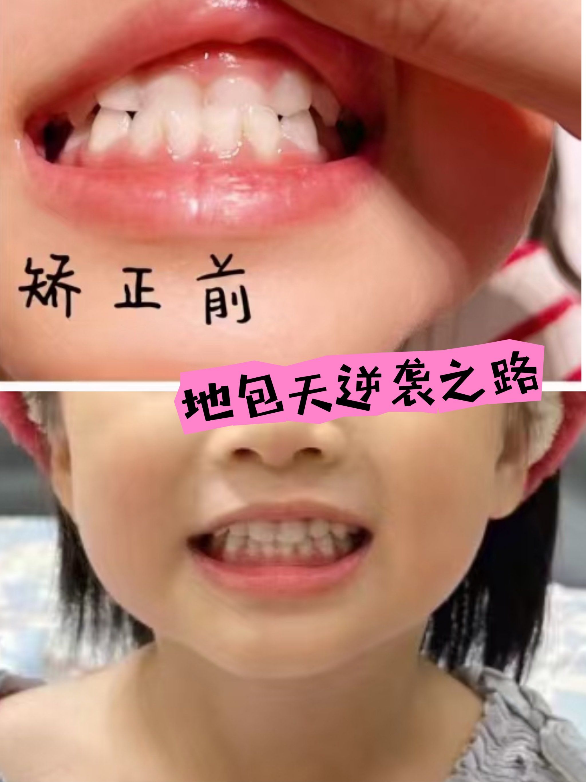 偶然间发现我崽不知道这么变成地包天了,于是各种做攻略查阅