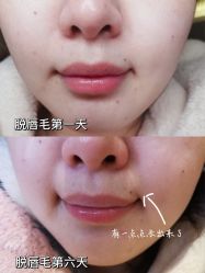 -嘉和医学脱毛中心