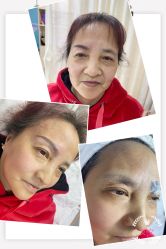 体验前-比华利美容医院