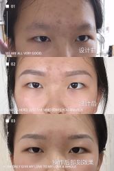 -久匠半永久纹眉