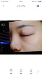 -丽美妍医疗美容·皮秒·立体分层抗衰