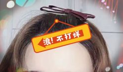 -大麦微针植发全国连锁