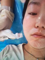 -杭州米兰柏羽医疗美容医院